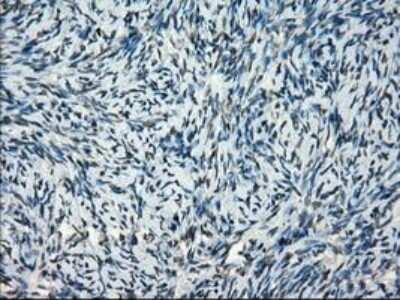Immunohistochemistry: Frk Antibody (OTI6D2) - Azide and BSA Free [NBP2-70775]