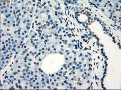 Immunohistochemistry: Frk Antibody (OTI6D2) - Azide and BSA Free [NBP2-70775]