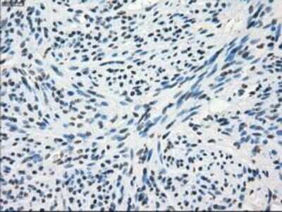 Immunohistochemistry: Frk Antibody (OTI6D2) - Azide and BSA Free [NBP2-70775]