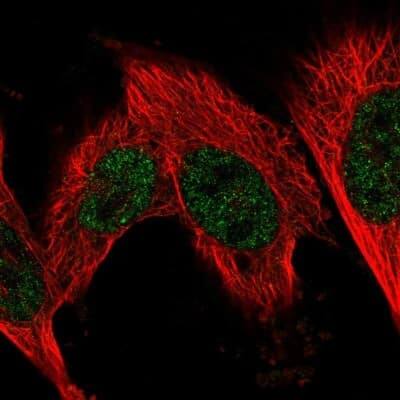 Immunocytochemistry/ Immunofluorescence: Fructosamine-3-kinase-related Antibody [NBP2-55370]