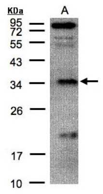 Western Blot: Fructosamine-3-kinase-related Antibody [NBP1-32151]