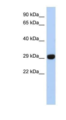 Western Blot: Fructosamine-3-kinase-related Antibody [NBP1-56367]