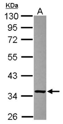 Western Blot: Fructosamine-3-kinase-related Antibody [NBP2-16536]