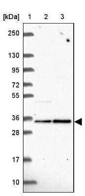 Western Blot: Fructosamine-3-kinase-related Antibody [NBP2-39063]