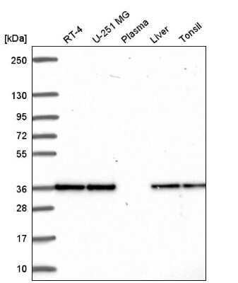 Western Blot: Fructosamine-3-kinase-related Antibody [NBP2-55370]