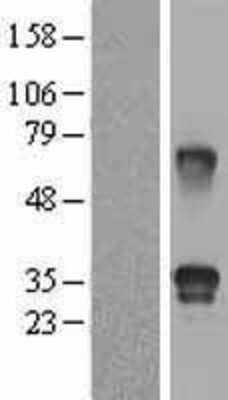 Western Blot: Follistatin-related Gene Protein/FLRG/Fstl3 Overexpression Lysate [NBL1-10848]