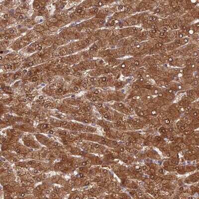 Immunohistochemistry-Paraffin: Fucose Mutarotase Antibody [NBP1-93896]