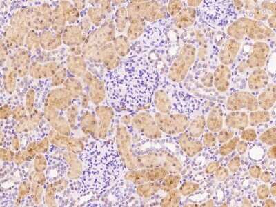 Immunohistochemistry-Paraffin: Fucose Mutarotase Antibody [NBP3-00239]