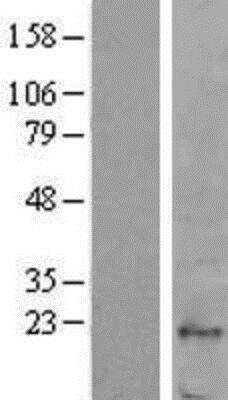 Western Blot: Fucose Mutarotase Overexpression Lysate [NBP2-04693]