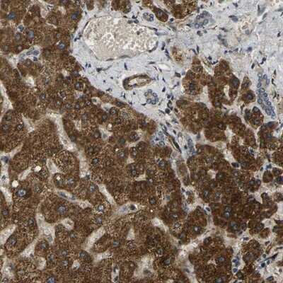 Immunohistochemistry-Paraffin: Fucosyltransferase 11/FUT11 Antibody [NBP1-81118]