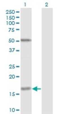 Western Blot: Fucosyltransferase 2/FUT2 Antibody (4C12) [H00002524-M02]