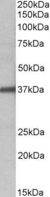 Western Blot: Fucosyltransferase 2/FUT2 Antibody [NBP2-26116]