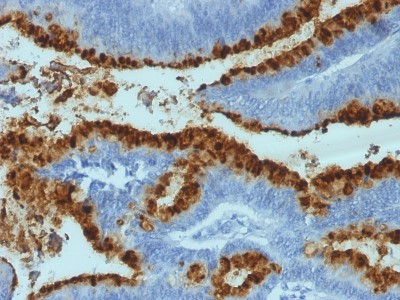 Immunohistochemistry-Paraffin: Fucosyltransferase 3/FUT3 Antibody (2-25LE; same as LWB01) [NBP3-13998]