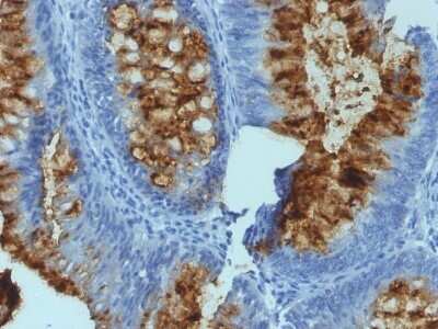 Immunohistochemistry-Paraffin: Fucosyltransferase 3/FUT3 Antibody (SPM194) - Azide and BSA Free [NBP2-47928]