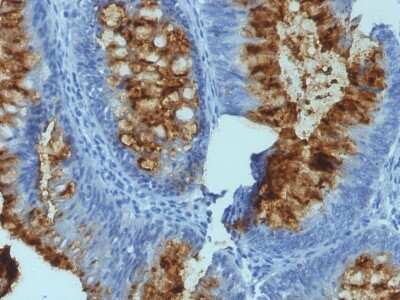 Immunohistochemistry-Paraffin: Fucosyltransferase 3/FUT3 Antibody (SPM194) [NBP2-44597]