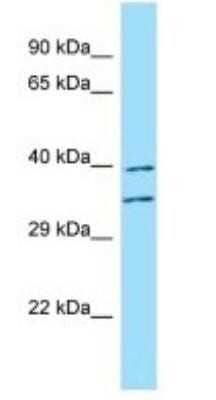 Western Blot: Fucosyltransferase 3/FUT3 Antibody [NBP1-98488]