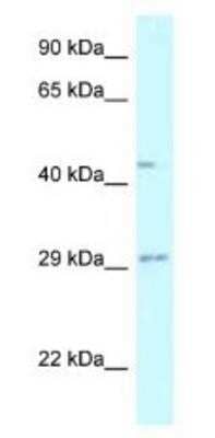 Western Blot: Fucosyltransferase 8/FUT8 Antibody [NBP1-79869]