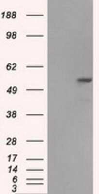 Western Blot: Fumarase Antibody (OTI1F10) [NBP1-47754]