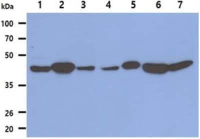 Western Blot: Fumarase Antibody (3F6)BSA Free [NBP2-59442]