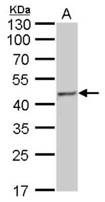 Western Blot: Fumarase Antibody (7612) [NBP2-43578]