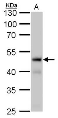 Western Blot: Fumarase Antibody (7612) [NBP2-43578]