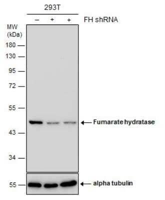 Western Blot: Fumarase Antibody (7612) [NBP2-43578]