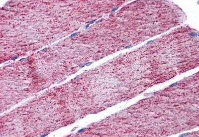 Immunohistochemistry-Paraffin: Fumarase Antibody [NB100-61663]