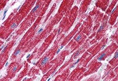 Immunohistochemistry-Paraffin: Fumarase Antibody [NB100-61663]