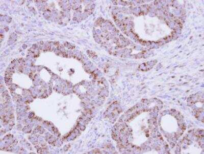 Immunohistochemistry-Paraffin: Fumarase Antibody [NBP1-31336]