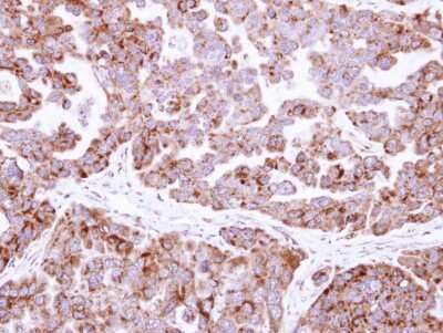 Immunohistochemistry-Paraffin: Fumarase Antibody [NBP1-32893]