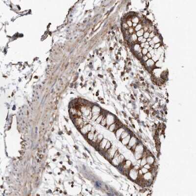 Immunohistochemistry-Paraffin: Fumarase Antibody [NBP1-89813]