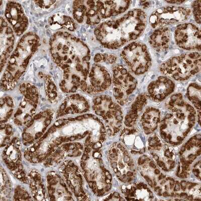 Immunohistochemistry-Paraffin: Fumarase Antibody [NBP1-89813]