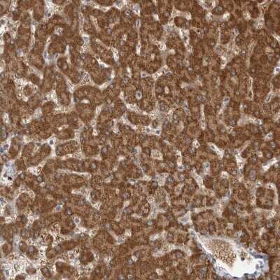 Immunohistochemistry-Paraffin: Fumarase Antibody [NBP1-89813]