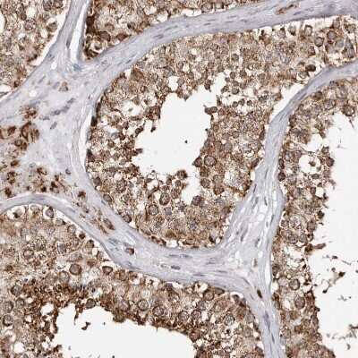 Immunohistochemistry-Paraffin: Fumarase Antibody [NBP1-89813]