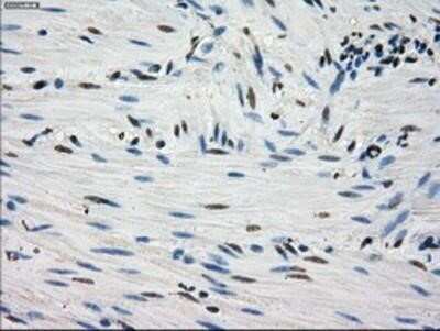 Immunohistochemistry: Fumarase Antibody (OTI1F10) - Azide and BSA Free [NBP2-70733]