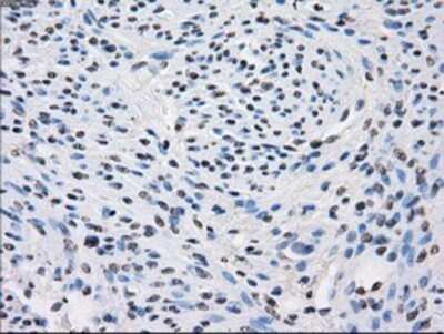 Immunohistochemistry: Fumarase Antibody (OTI1F10) - Azide and BSA Free [NBP2-70733]