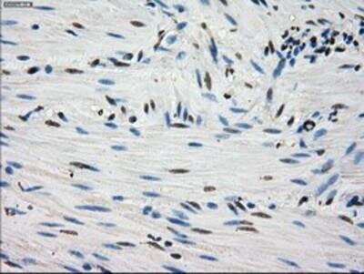 Immunohistochemistry: Fumarase Antibody (OTI1F10) [NBP1-47754]