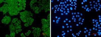 Immunocytochemistry/ Immunofluorescence: Fumarase Antibody (S08-3F2) [NBP3-15029]