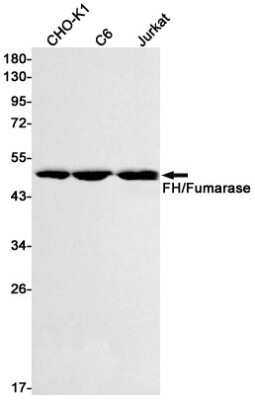 Western Blot: Fumarase Antibody (S08-3F2) [NBP3-15029]