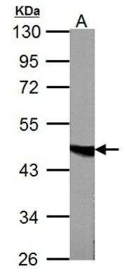 Western Blot: Fumarase Antibody [NBP1-31336]