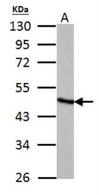 Western Blot: Fumarase Antibody [NBP1-31336]