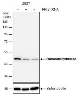 Knockdown Validated: Fumarase Antibody [NBP1-31336]