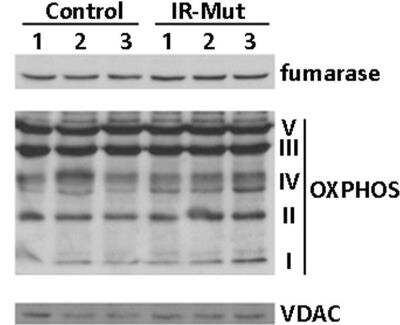 Western Blot: Fumarase Antibody [NBP1-31336]