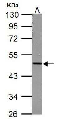 Western Blot: Fumarase Antibody [NBP1-32893]