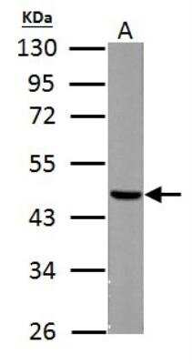 Western Blot: Fumarase Antibody [NBP1-32893]