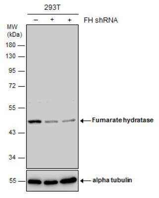 Western Blot: Fumarase Antibody [NBP1-32893]