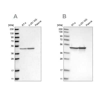 Western Blot: Fumarase Antibody [NBP1-89813]