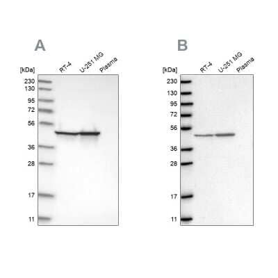 Western Blot: Fumarase Antibody [NBP1-89814]