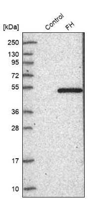 Western Blot: Fumarase Antibody [NBP1-89815]