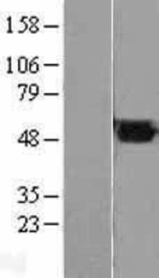 Western Blot: Fumarase Overexpression Lysate [NBL1-10713]